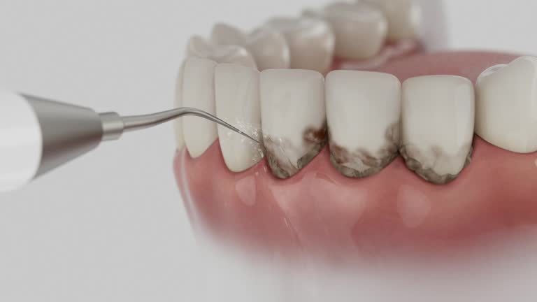Reliable Dental contractor in Carthage, TN by Smile Center Dentistry